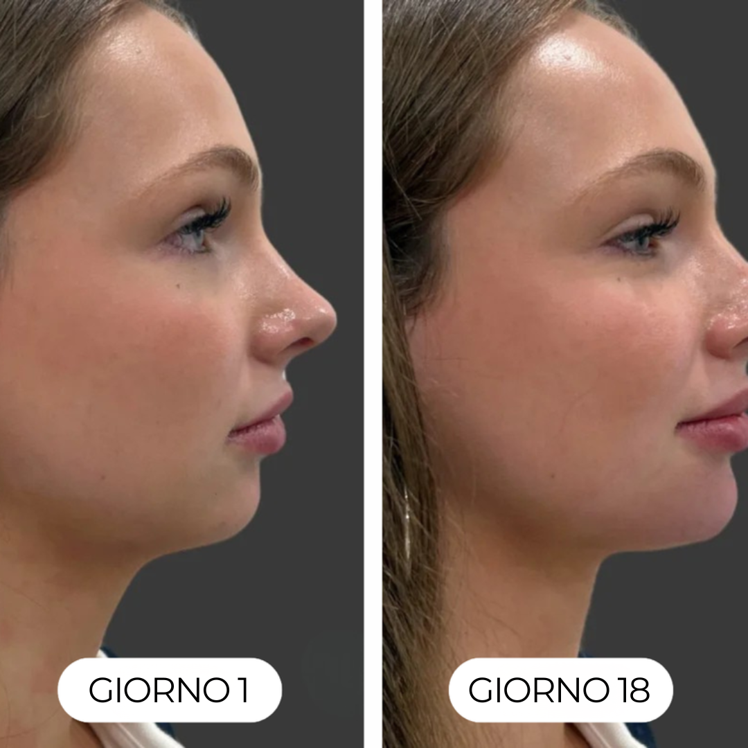 Spazzola per drenaggio linfatico